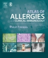 Atlas of Allergies and Clinical Immunology: Textbook with CD-ROM артикул 4389a.