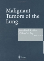 Malignant Tumors of the Lung : Evidence-based Management артикул 4433a.