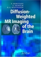 Diffusion-Weighted MR Imaging of the Brain артикул 4447a.